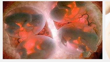 1、胎儿鉴别6大方法:怀孕做亲子鉴定
