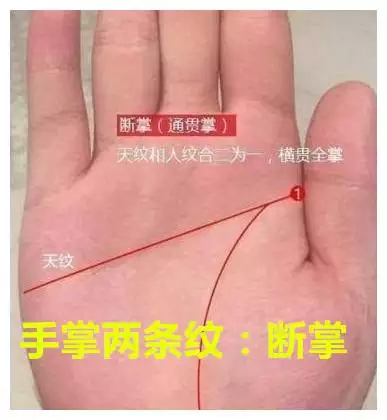 3、手掌的三条线正确图解:手上的三条线分别代表什么图解