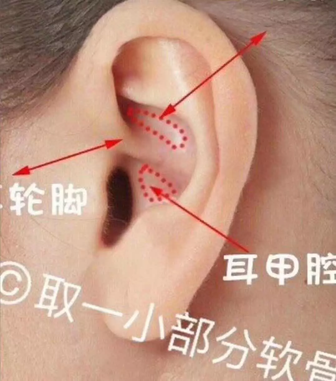 2、耳朵硬和软都代表什么意思:汉字的偏旁中，有软耳和硬耳的说法吗？其区别是什么？