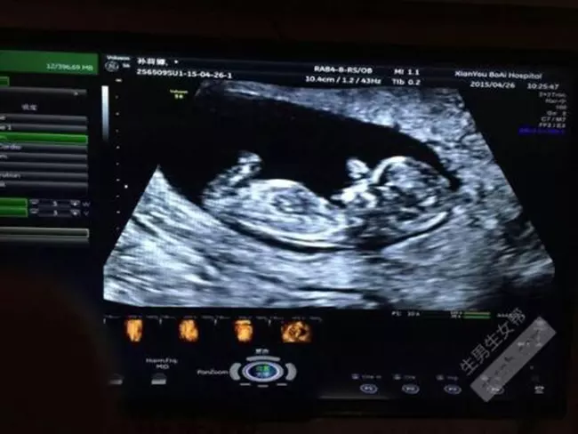 怀孕4个月看男女图片：四个月的胎儿是什么样子？大概会有多小呢？
