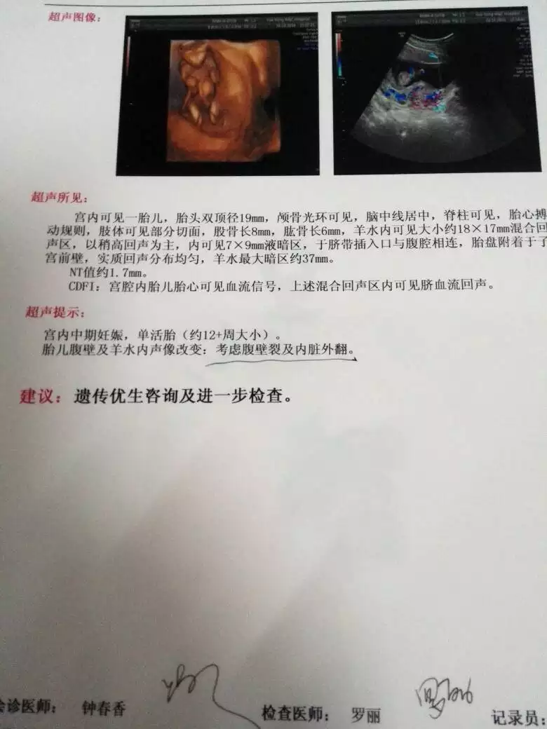 4、怀孕做四维多少钱一次:怀孕多久后可以做检查，杭州做四维彩超检查得花多少钱
