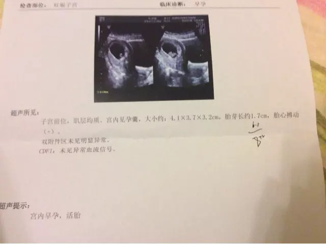 4、其实看孕囊很准:请问姐妹们,怀孕7周左右B超孕囊的长圆来看男女真的很准么?