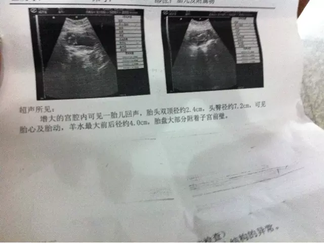 怀孕7个月，双顶径8.0，股骨长5.4，右后壁，是男孩女孩