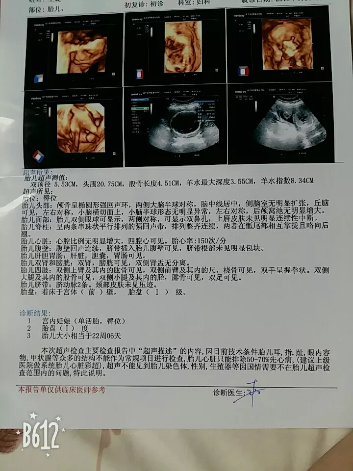 3、已生男孩的四维彩超图:6个月胎儿四维彩超图从那些可看出是男孩?