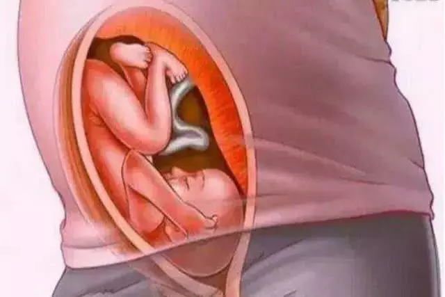 1、怎么知道自己有没有怀孕:怎么判断是否怀孕?