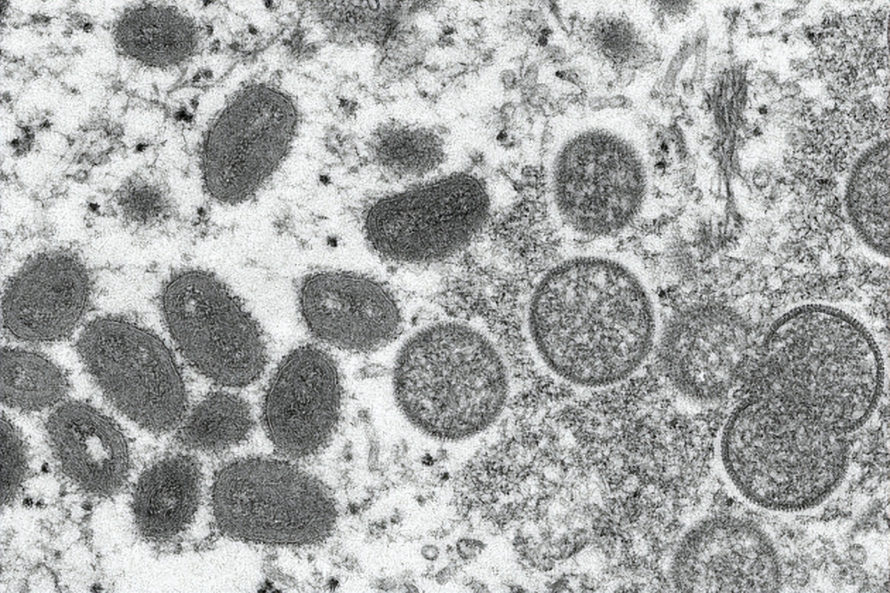 猴痘病毒是加强版本的天花病毒？比天花还可怕？专家谈猴痘疫情