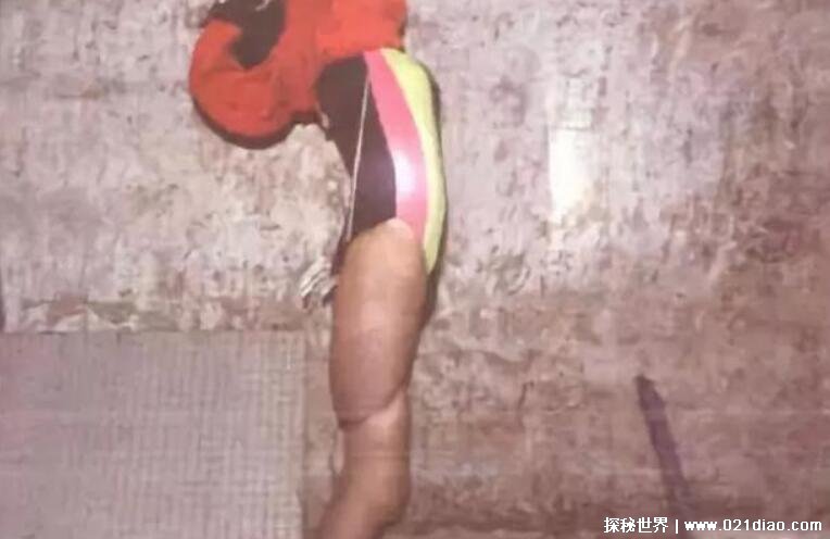 09重庆红衣男孩事件真相，疑似因受虐癖致死(官方称自杀)