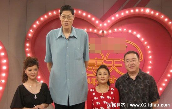 中国最高的人是谁身高多少，山西张俊才(手术后定格在2米42)