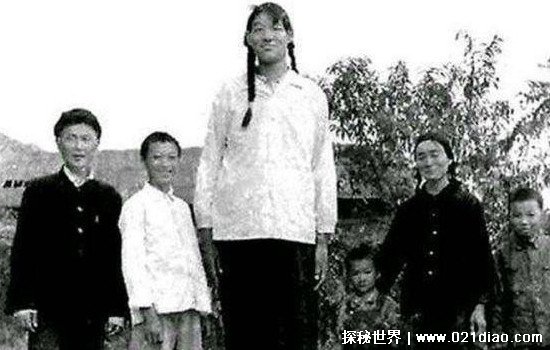 中国最高的人是谁身高多少，山西张俊才(手术后定格在2米42)