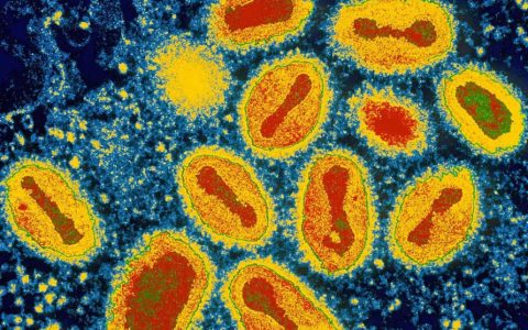 霍乱为何会被列为甲类传染病-甲类传染病包括哪三种