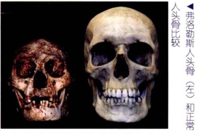 印尼"小矮人”弗洛勒斯人可能是早期新人种