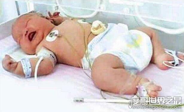 世界上最大的婴儿，重达36斤(最小的婴儿竟只有280克)