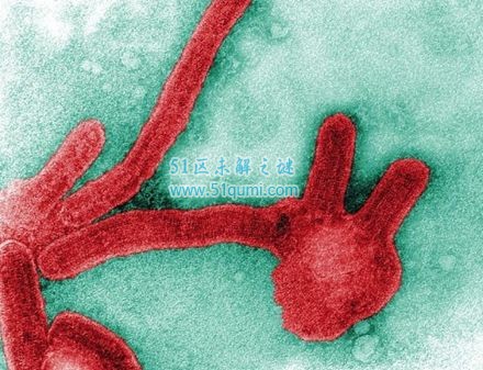 马尔堡病毒的传播途径及预防 与埃博拉一样致命的病毒
