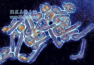 马尔堡病毒的传播途径及预防 与埃博拉一样致命的病毒